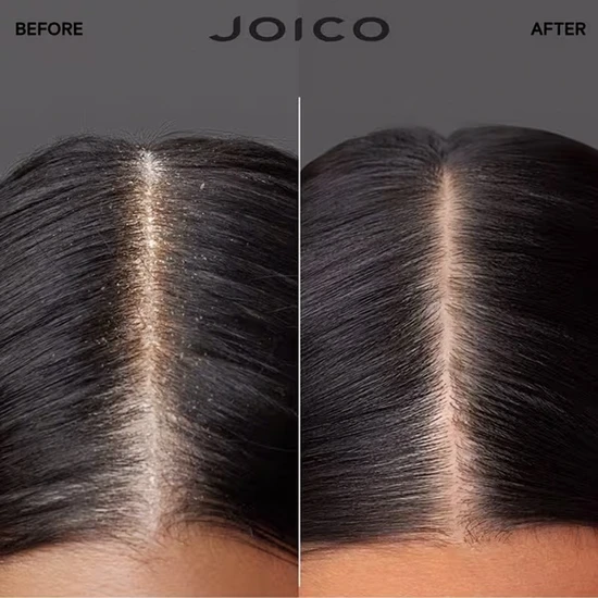 Joico Scalp Vitality Refreshing Shampoo 300ml