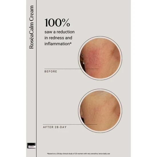 NAYA RoseaCalm Cream 5ml