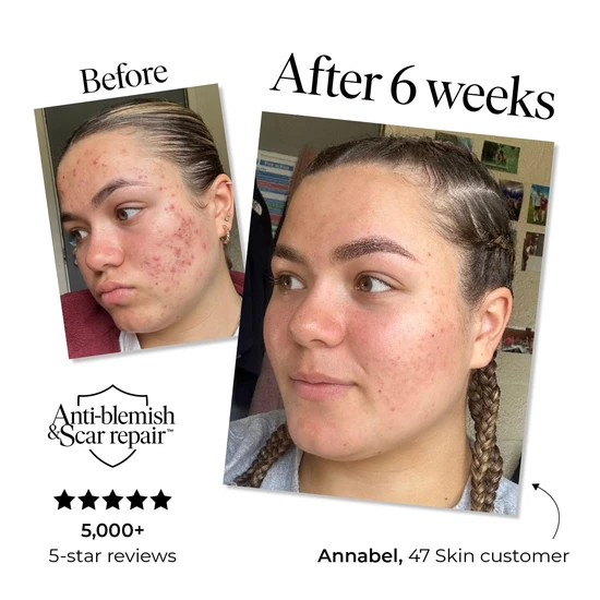 47 Skin Anti-Blemish & Scar Repair Serum 15ml