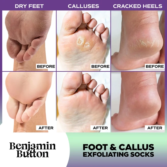 Benjamin Button Exfoliating Foot Mask x 5