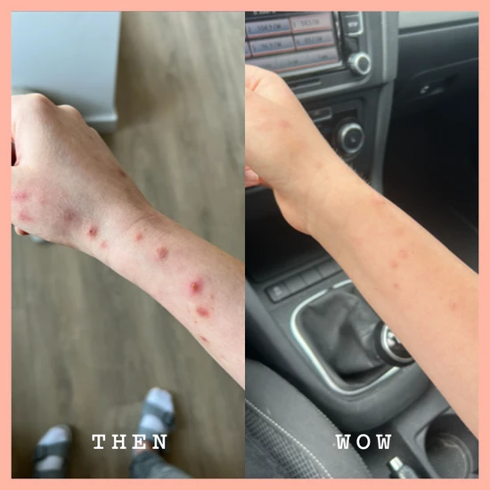 Frank Body Squeaky Cheeks