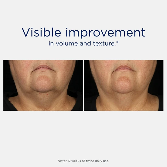 NeoStrata Skin Active Tri-Therapy Lifting Serum Anti-Ageing 30ml