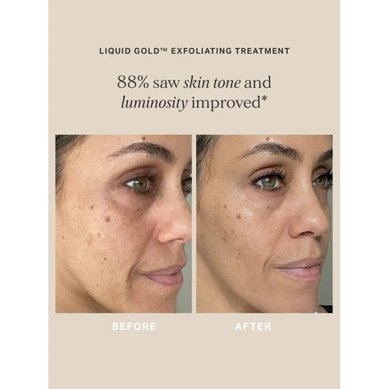 Alpha-H Liquid Gold To Go Gift Set