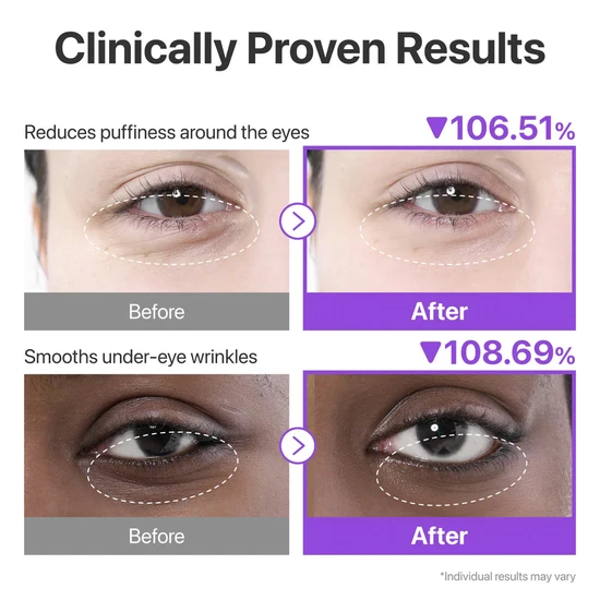 Numbuzin No.9 NAD Collagen Under Eye Patches x5