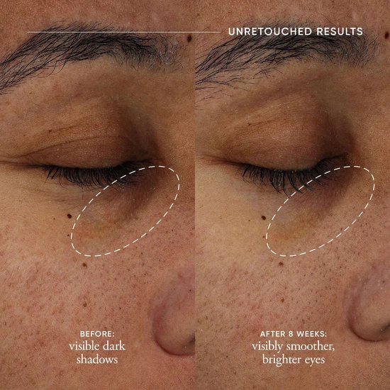 Philosophy Dose Of Wisdom Dark Circle Brightening Eye Cream 15ml