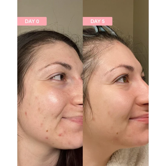 Sand & Sky Pro Youth Dark Spot Serum 30ml