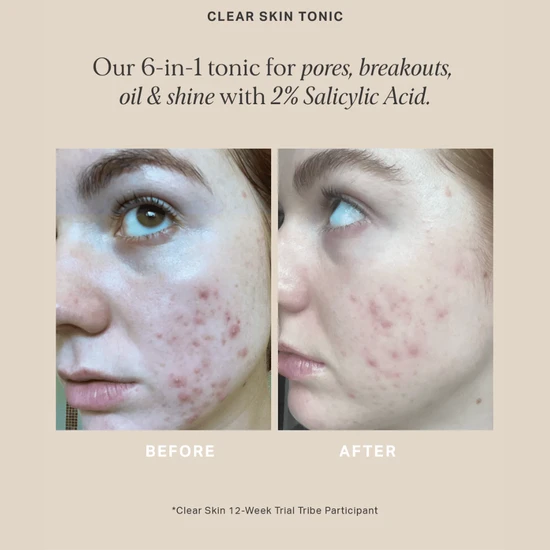 Alpha-H Clear Skin Tonic With 2% BHA Salicylic Acid 100ml