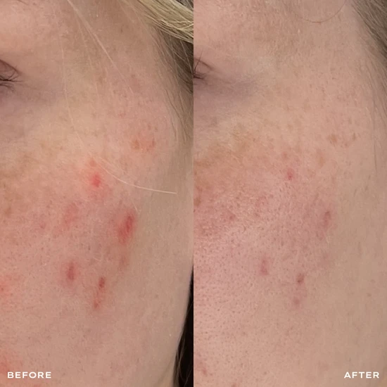 MANTLE The Spot Solution 30ml