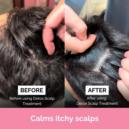 FUL Detox Scalp Treatment 150ml