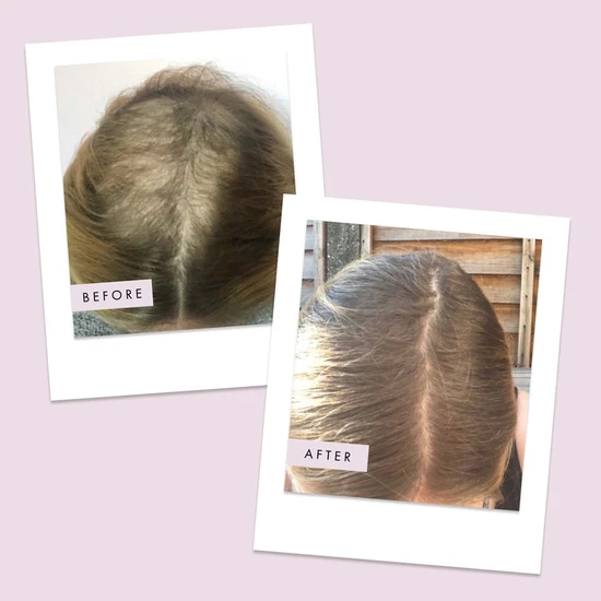 Hair Gain Capsules 60 capsules (1 Month)