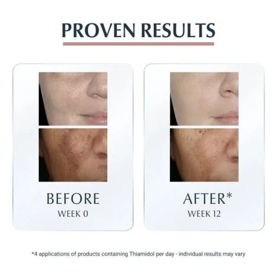 Eucerin Anti-Pigment Dual Serum 30ml