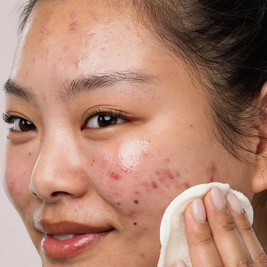 SVR SEBIACLEAR Micellar Water Refill Bag - 400ml