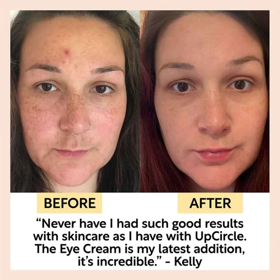 UpCircle Beauty Caffeinated Skin Duo 30ml The Face Serum & 15ml The Eye Cream