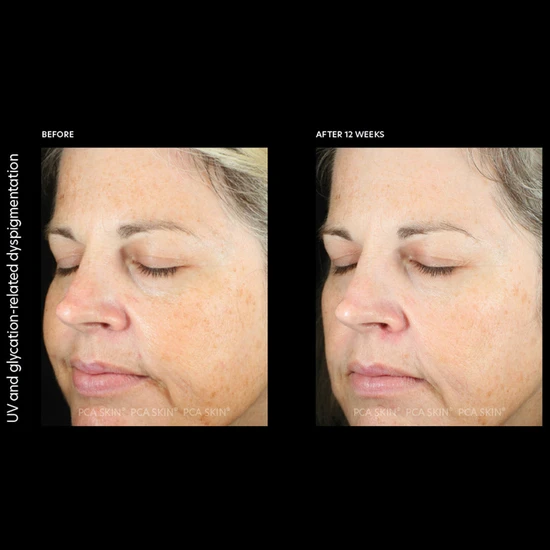 PCA SKIN Pigment Gel Pro 29ml