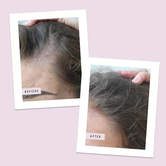 Hair Gain Scalp Foam 50ml