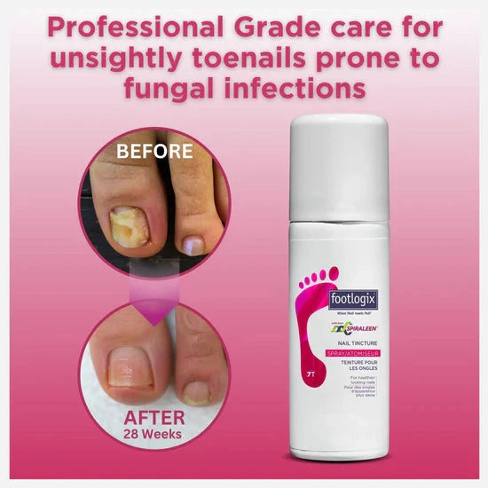 Footlogix Toe Nail Tincture 50ml