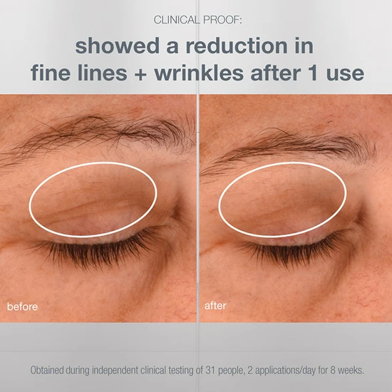 Dermalogica Phyto Nature Lifting Eye Cream 15ml