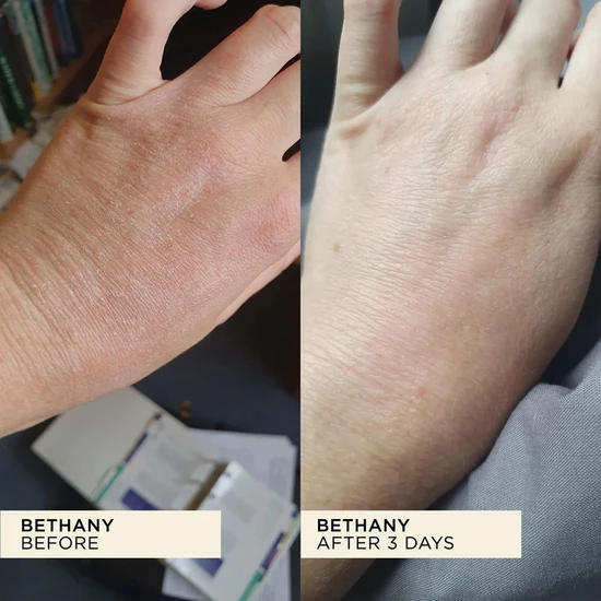 Wonderbalm Wonderbalm 20ml