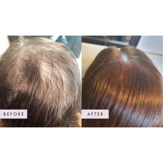 Hair Gain Gummies 60 Gummies (1 Month)