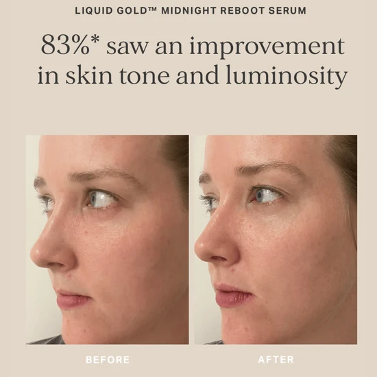 Alpha-H Midnight Reboot Serum 10ml