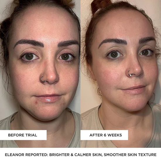 BeautyPro LED Wand 5 In 1 Anti-Ageing Device