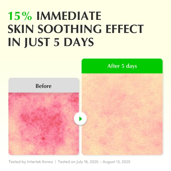 Eqqualberry Green Aid Aloe PDRN Calming Serum 30ml