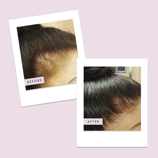 Hair Gain Gummies 60 Gummies (1 Month)