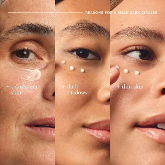 Philosophy Dose Of Wisdom Dark Circle Brightening Eye Cream 15ml