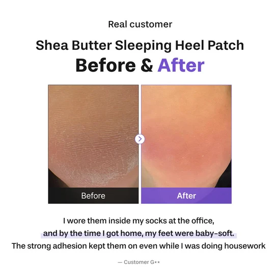 BAREN Shea Butter Sleeping Heel Patch x10
