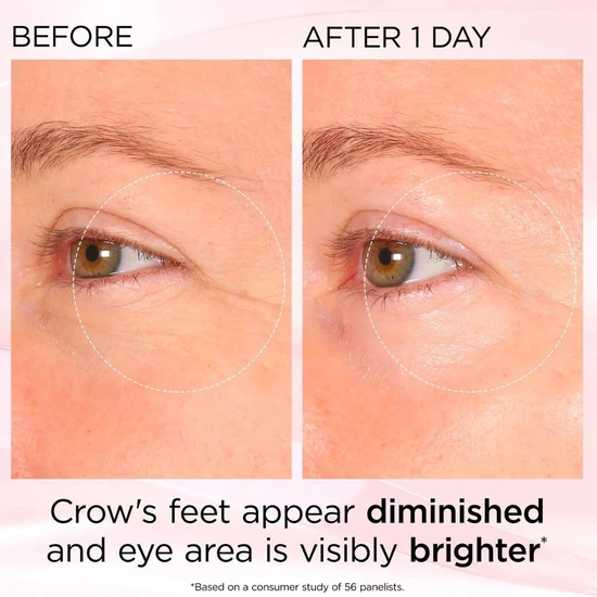 Elizabeth Arden Retinol + HPR Ceramide Rapid Skin Renewing Eye Cream 15ml