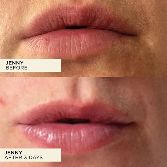 Wonderbalm Lip Balm 10ml