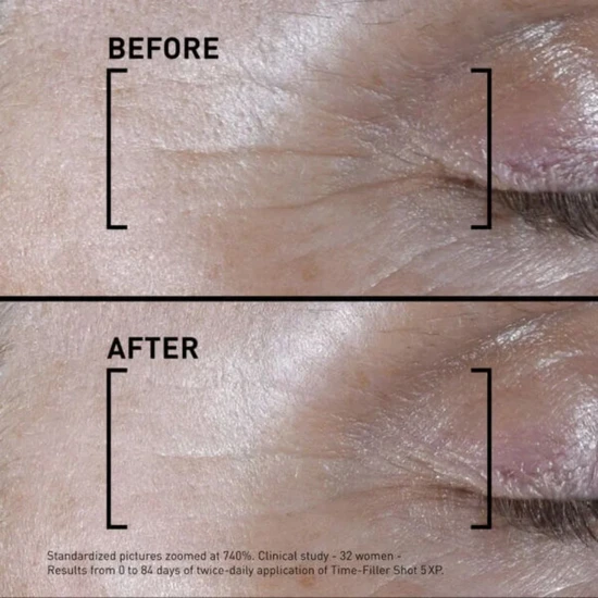 Filorga Time Filler Shot 5XP Concentrated Serum 15ml