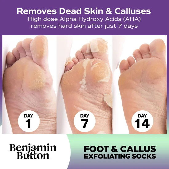 Benjamin Button Exfoliating Foot Mask x 5