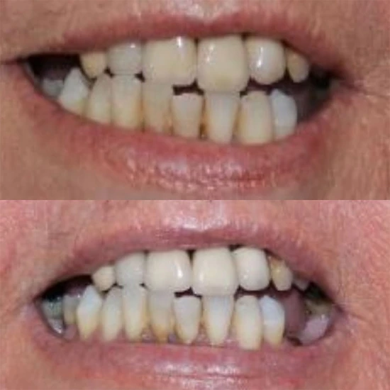 Smile Science Harley Street Professional Vita-White Toothpaste