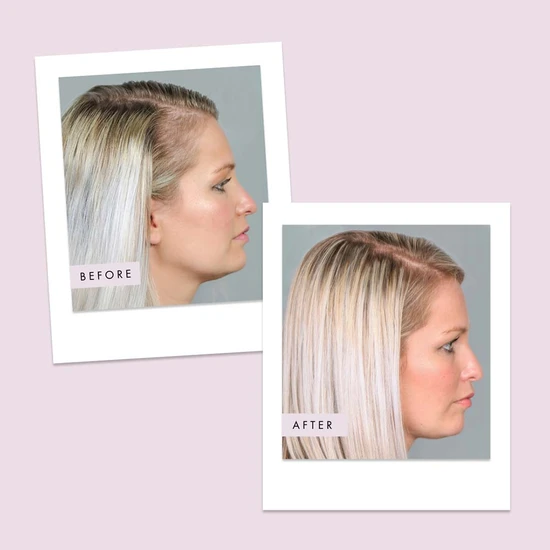 Hair Gain Capsules 60 capsules (1 Month)