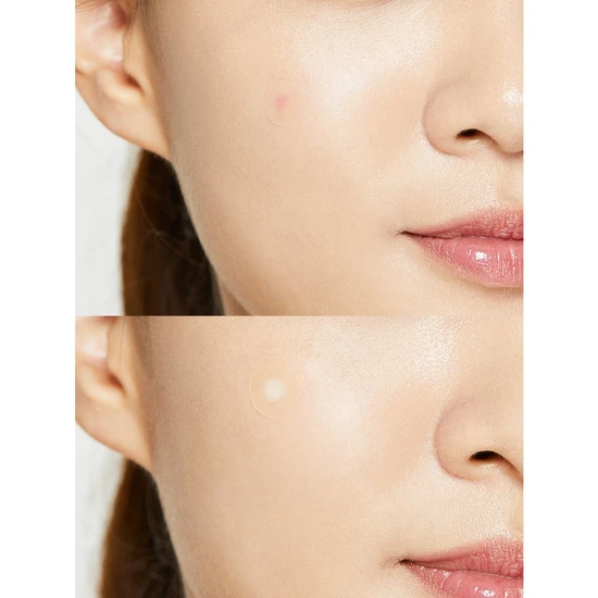 CosRx Acne Pimple Master Patch 24 Patches