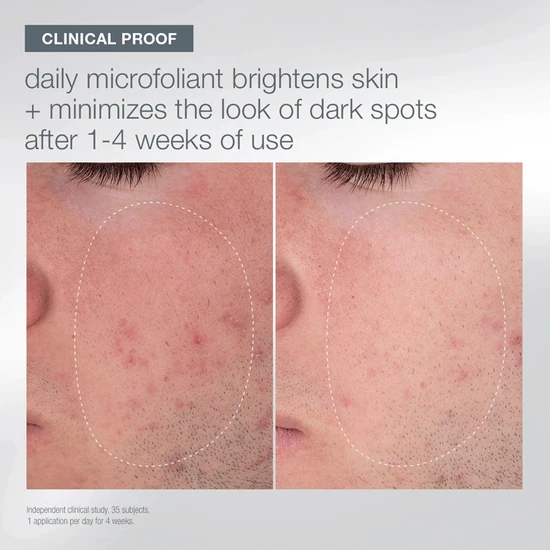 Dermalogica Your Moment Of Expertise Gift Set 150ml Cleanser, 74g Microfoliant, 15ml Eye Cream, 30ml Serum, 30ml Retinol Serum, 50ml Skin Recovery, Headband, Fan Brush & Gua Sha