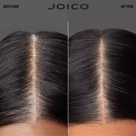 Joico Scalp Vitality Exfoliating Foaming Scrub 177ml