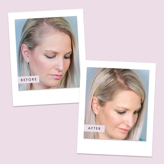 Hair Gain Capsules 60 capsules (1 Month)