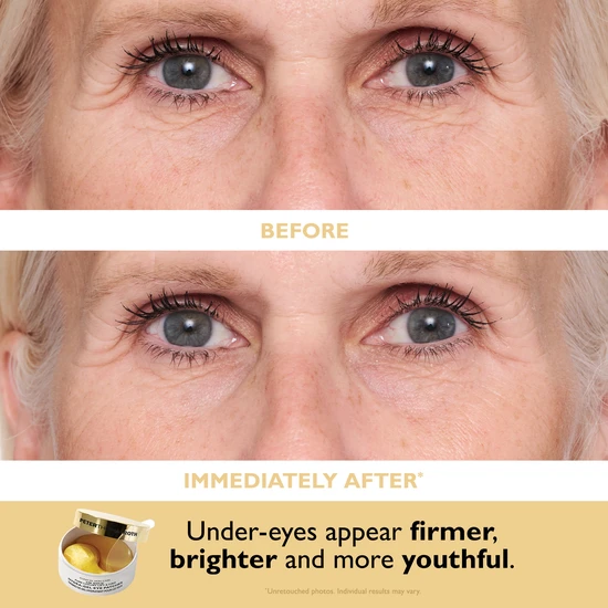 Peter Thomas Roth 24k Gold 2-Piece Kit