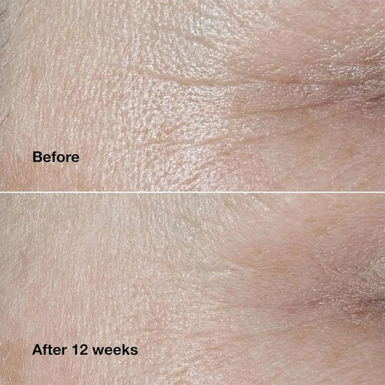 Clinique Smart Clinical Repair Wrinkle Correcting Cream SPF 30 50ml