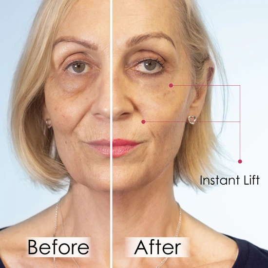 skinChemists Wrinkle Killer Instant Face Lift 5 x 2ml