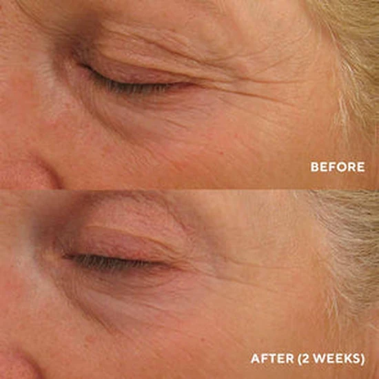 HydroPeptide Eye Authority 15ml