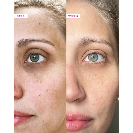 Sand & Sky Anti-Ageing Eye Cream 20g