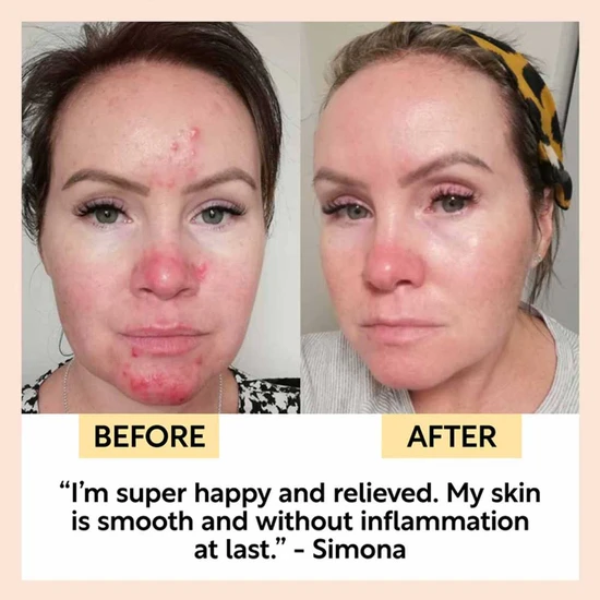 UpCircle Beauty Night Cream With Hyaluronic Acid & Niacinamide 55ml