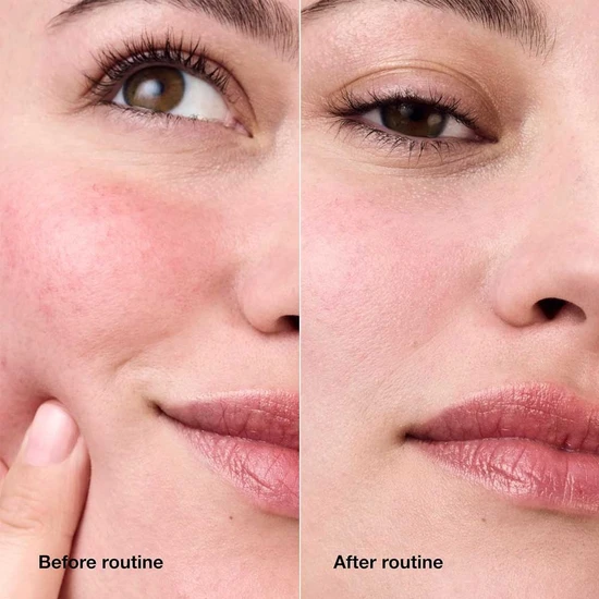 Clinique Redness Solutions Daily Relief Cream