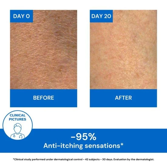 Uriage Xemose Lipid-Replenishing Anti-Irritation Cream 200ml