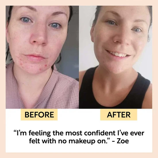 UpCircle Beauty SPF 25 Mineral Sunscreen 60ml