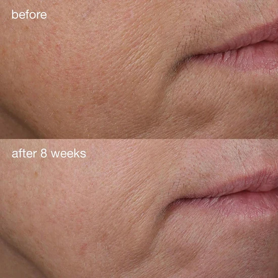 Dermalogica Phyto Nature Serum