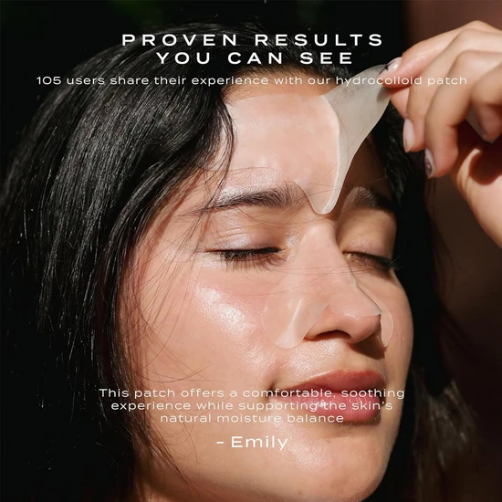 Vue Hydrocolloid Forehead Patches x5
